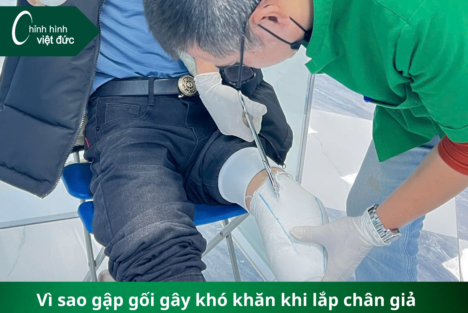 Tại sao tình trạng gập gối lại ảnh hưởng đến lắp chân giả