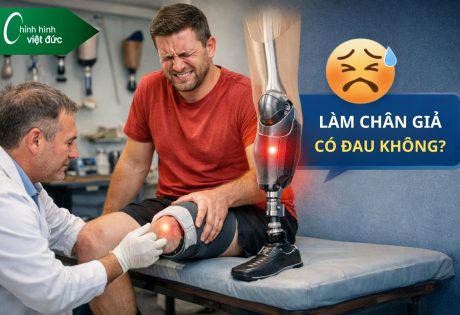 Làm chân giả có đau không