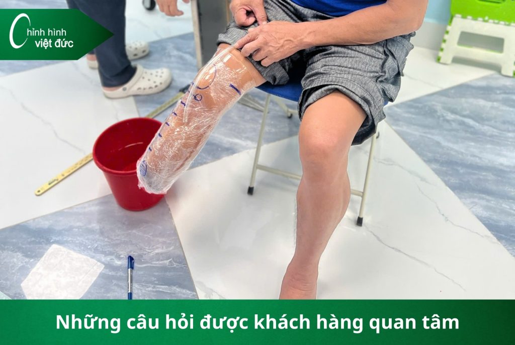 làm chân giả có đau không