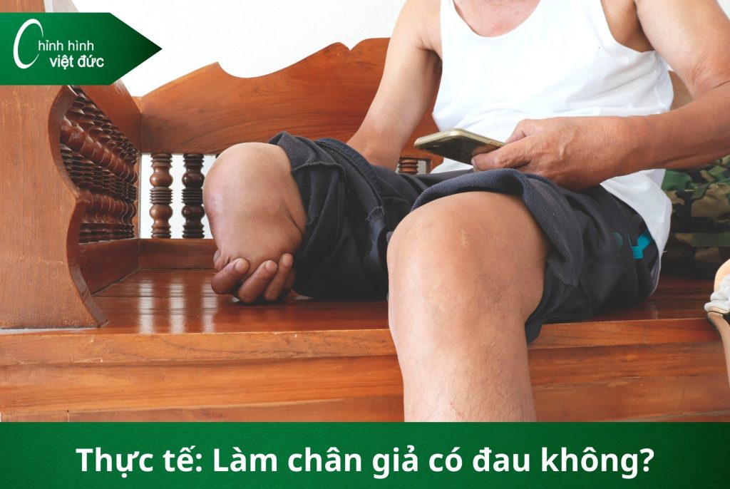 Làm chân giả có đau không