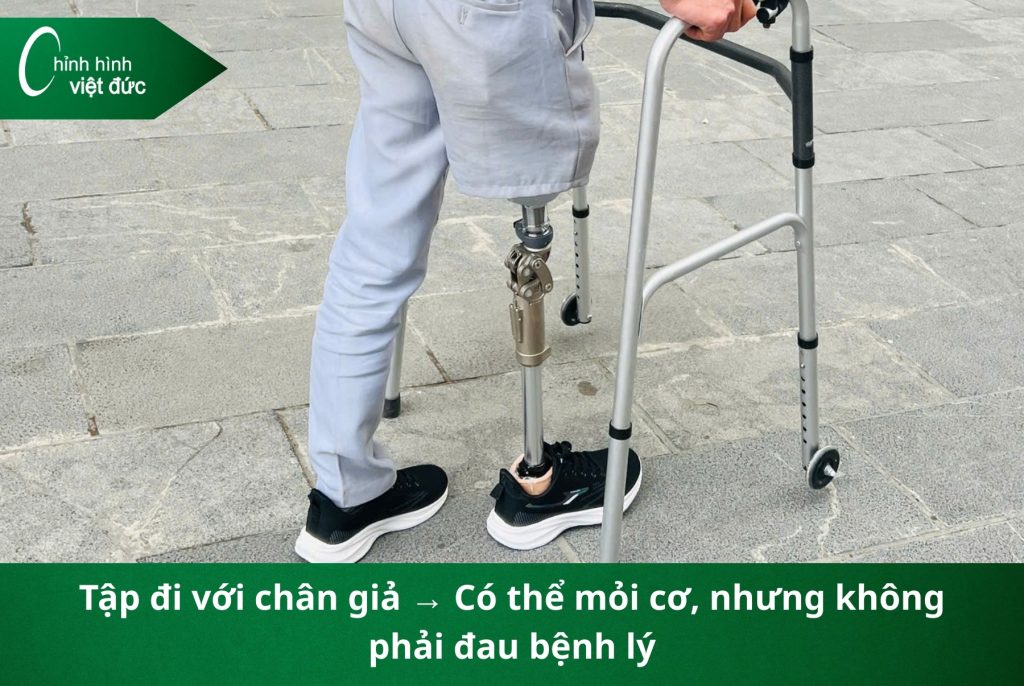 làm chân giả có đau không