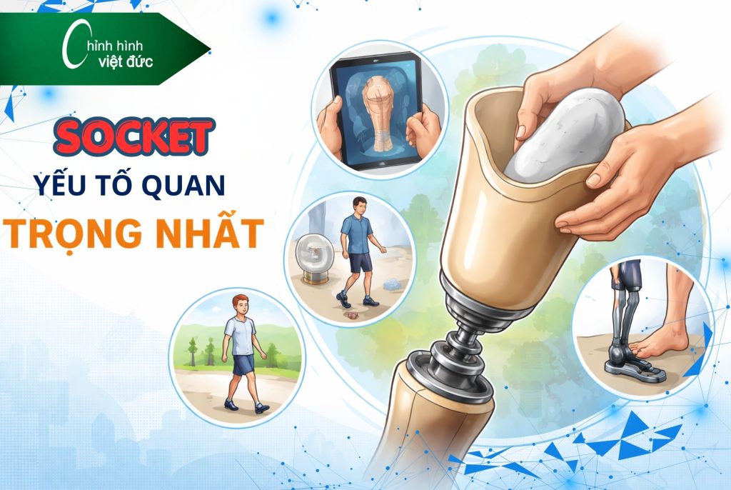 Làm chân giả giá bao nhiêu 
