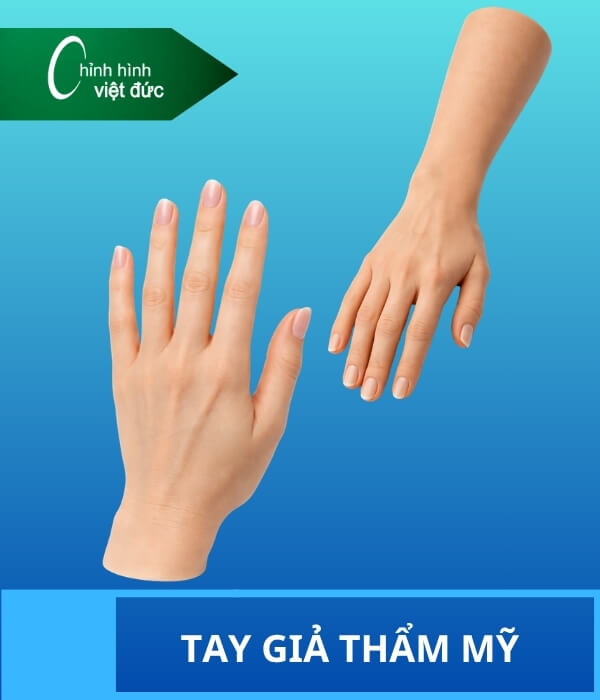 Tay giả thẩm mỹ