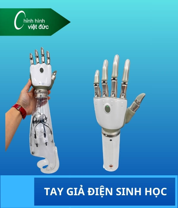 Tay giả điện sinh học