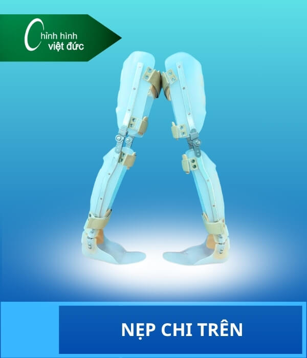 Nẹp chi trên