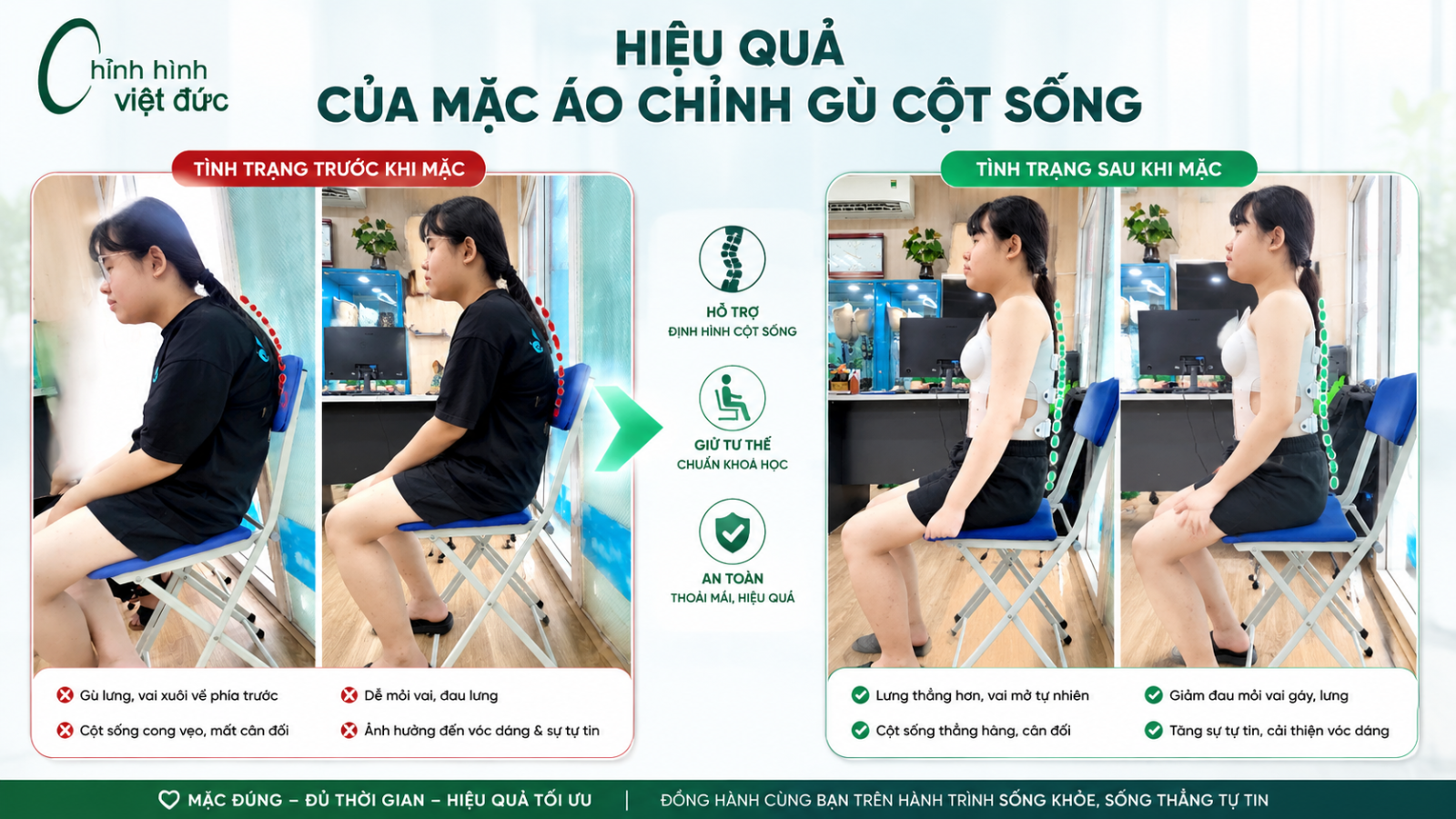 mẫu áo chỉnh gù cong vẹo cột sống