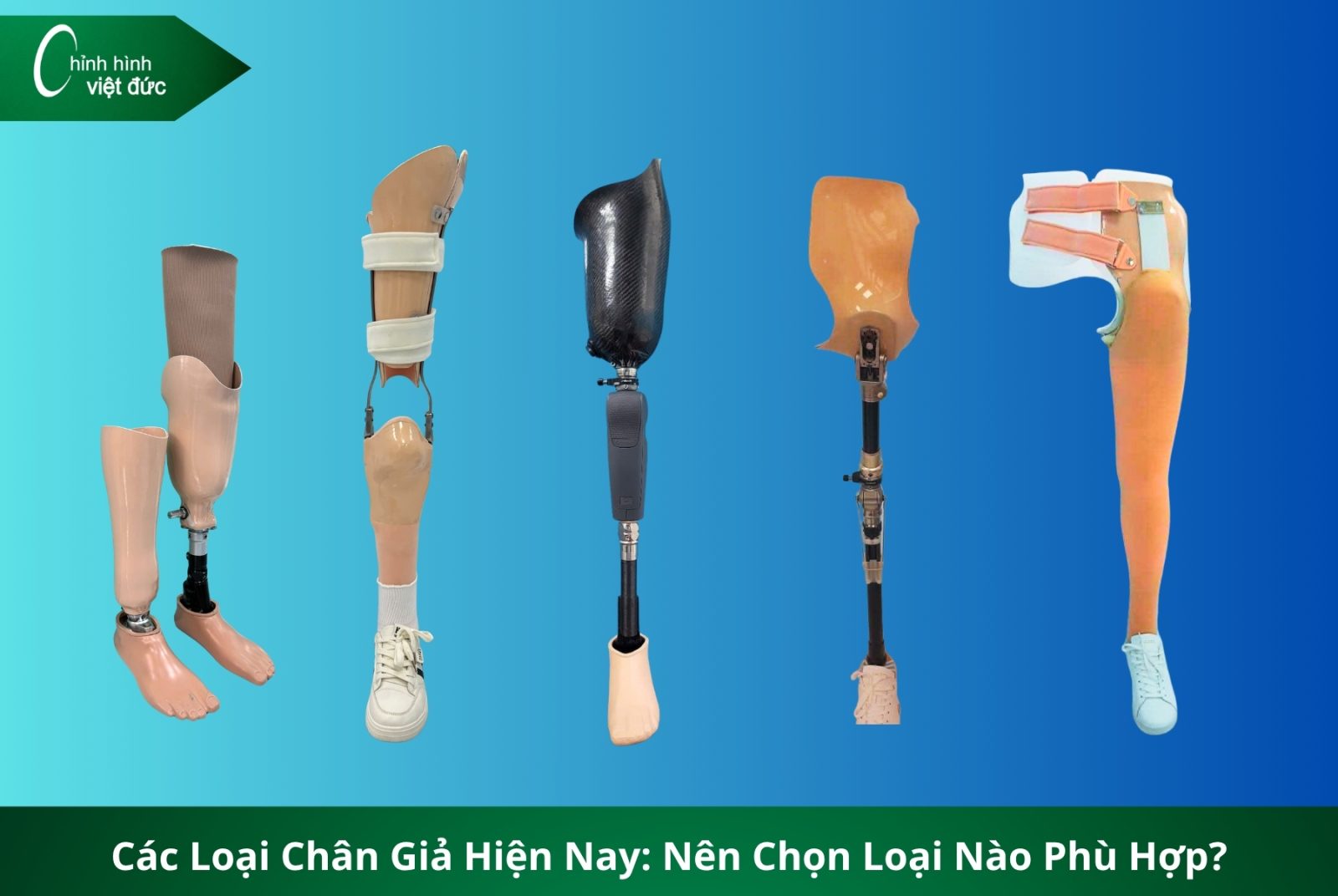 Các Loại Chân Giả Hiện Nay: Nên Chọn Loại Nào Phù Hợp