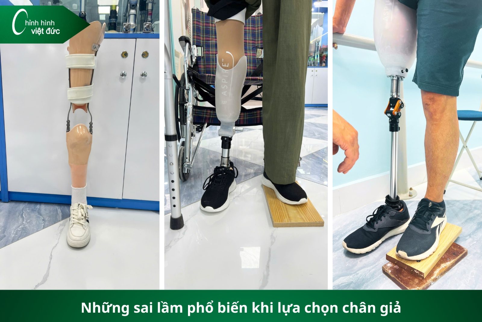 Các Loại Chân Giả Hiện Nay: Nên Chọn Loại Nào Phù Hợp