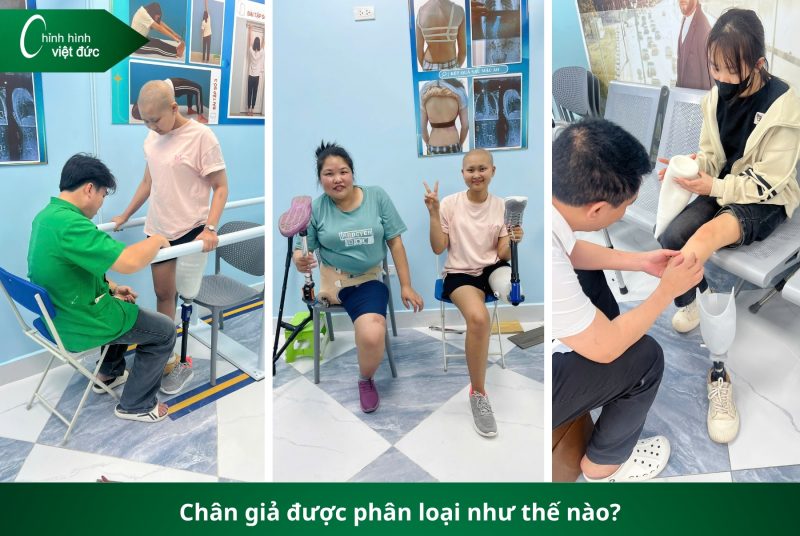 Các Loại Chân Giả Hiện Nay: Nên Chọn Loại Nào Phù Hợp