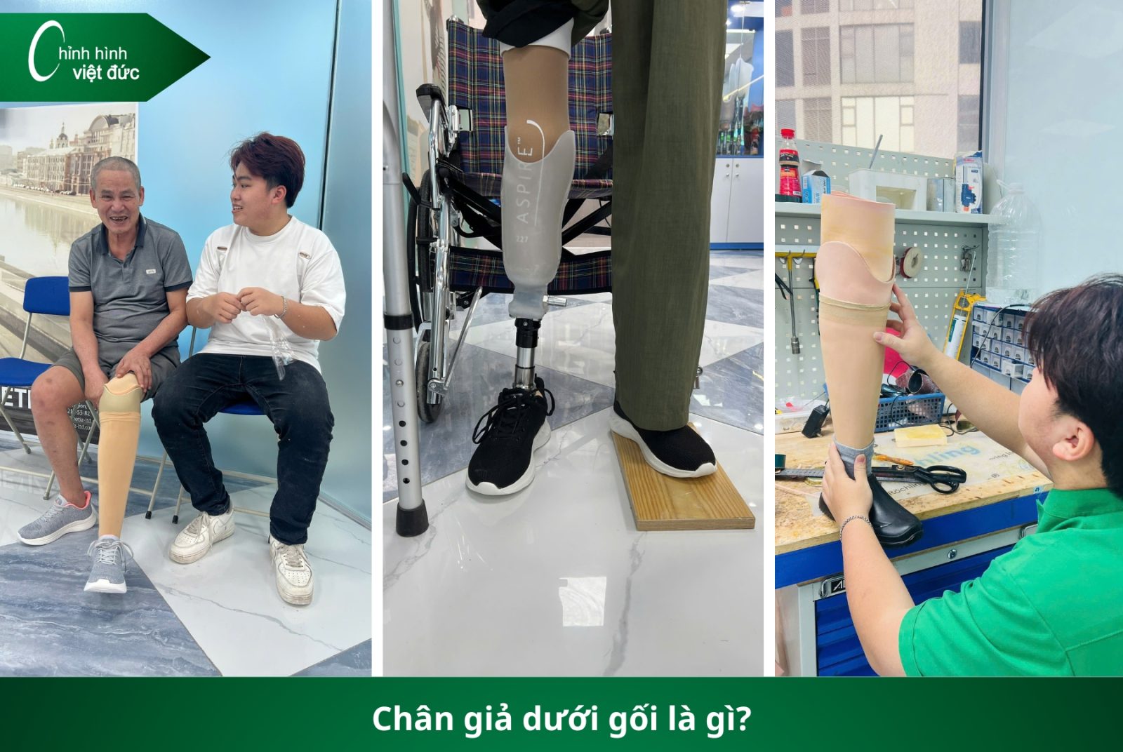 Các Loại Chân Giả Hiện Nay: Nên Chọn Loại Nào Phù Hợp