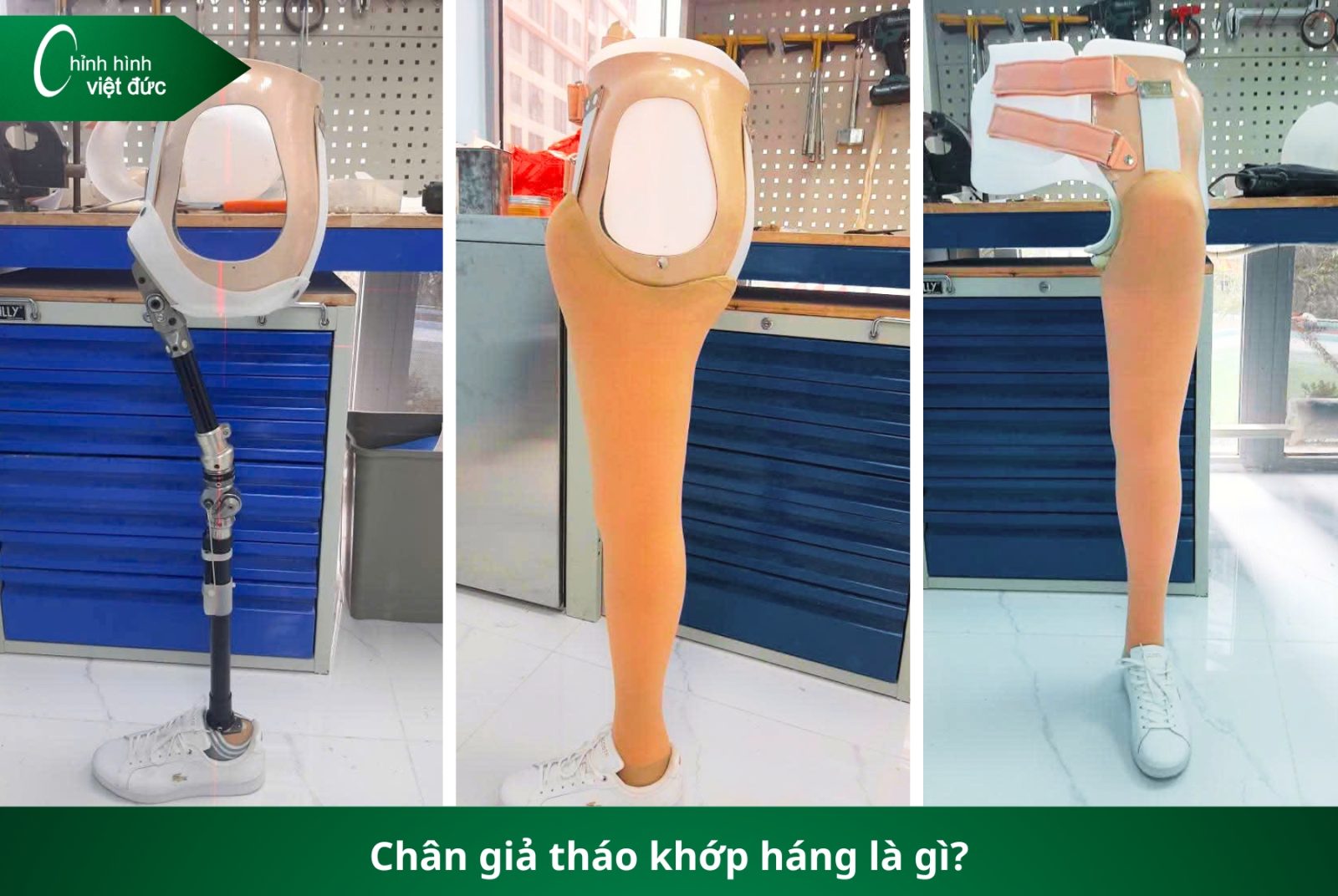 Các Loại Chân Giả Hiện Nay: Nên Chọn Loại Nào Phù Hợp