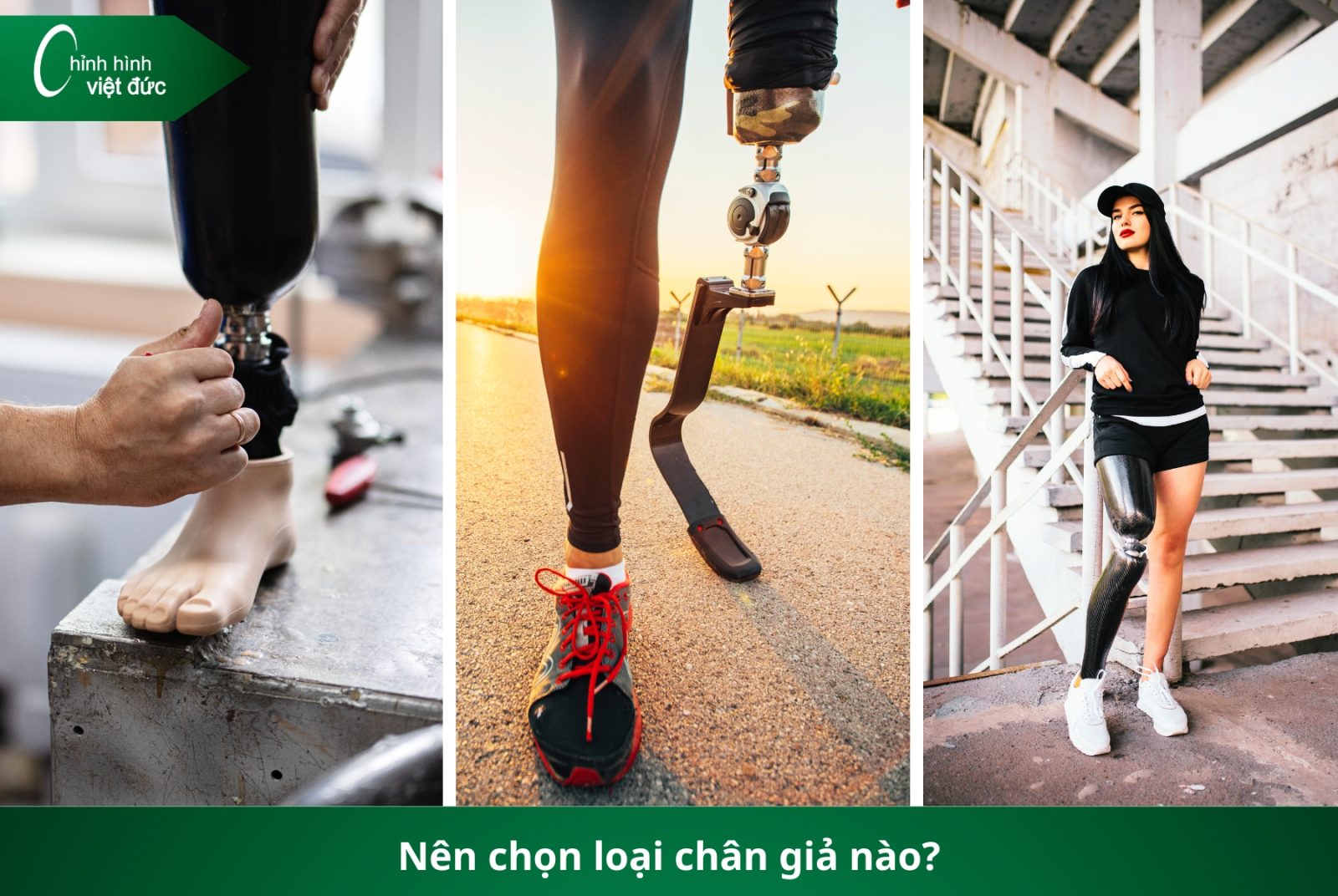 Các Loại Chân Giả Hiện Nay: Nên Chọn Loại Nào Phù Hợp