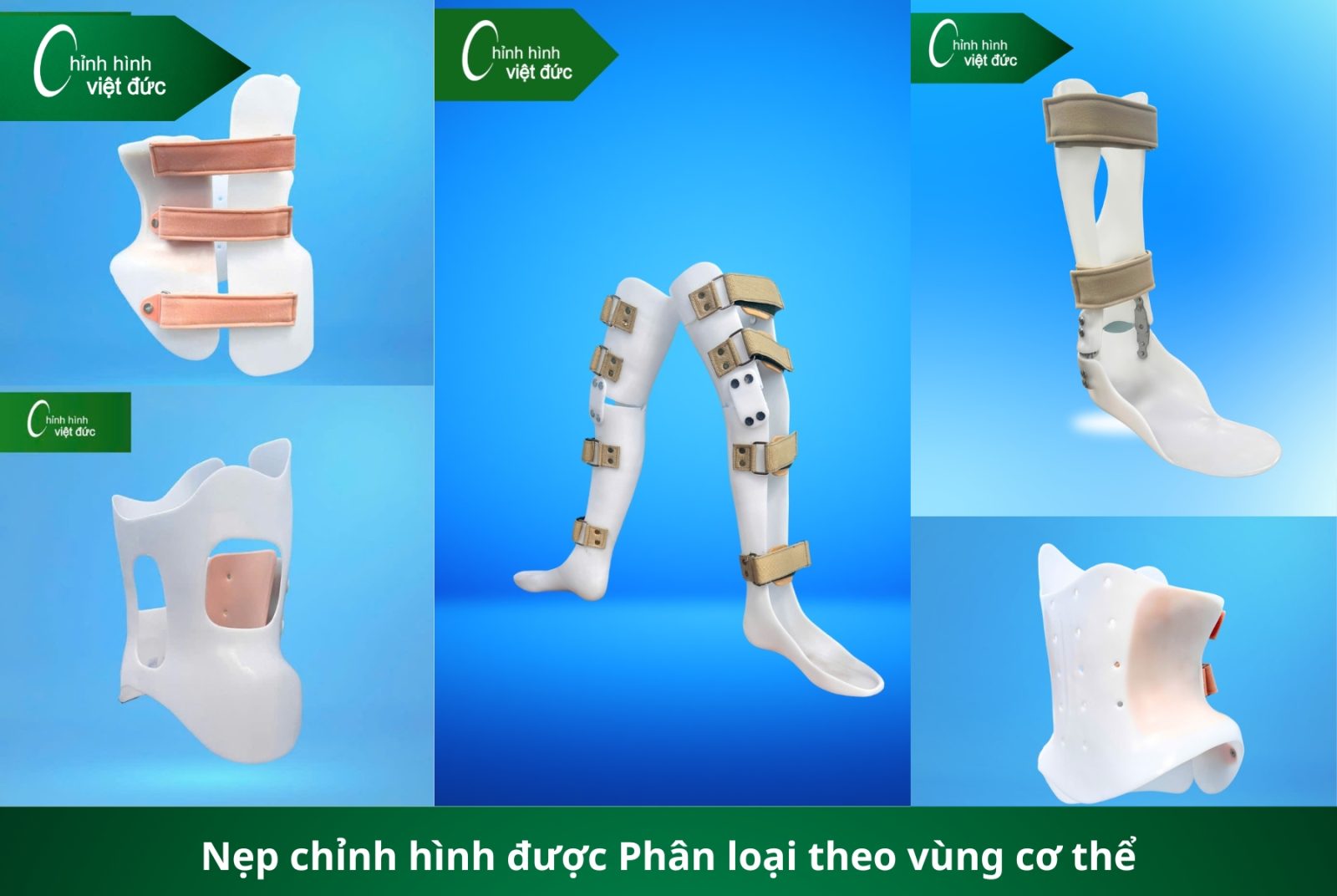 Các Loại Nẹp Chỉnh Hình Và Giải Pháp 