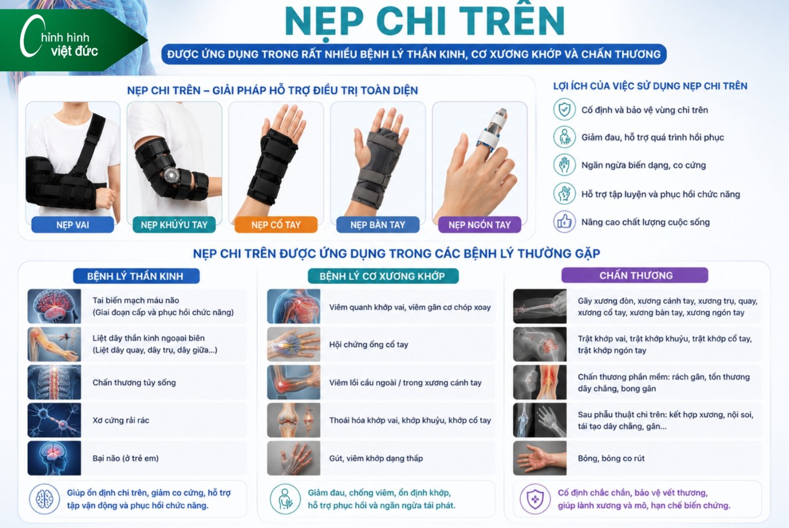 Các Loại Nẹp Chỉnh Hình Và Giải Pháp Phục Hồi Hiện Nay