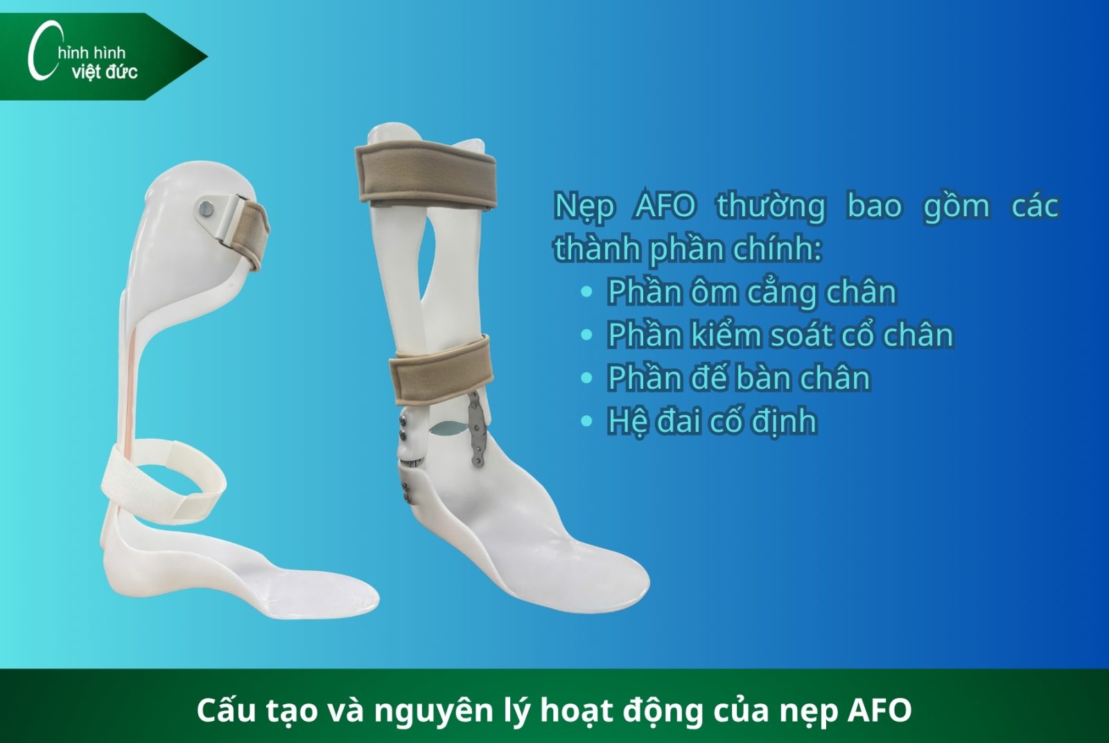 Các Loại Nẹp Chỉnh Hình Và Giải Pháp Phục Hồi Hiện Nay