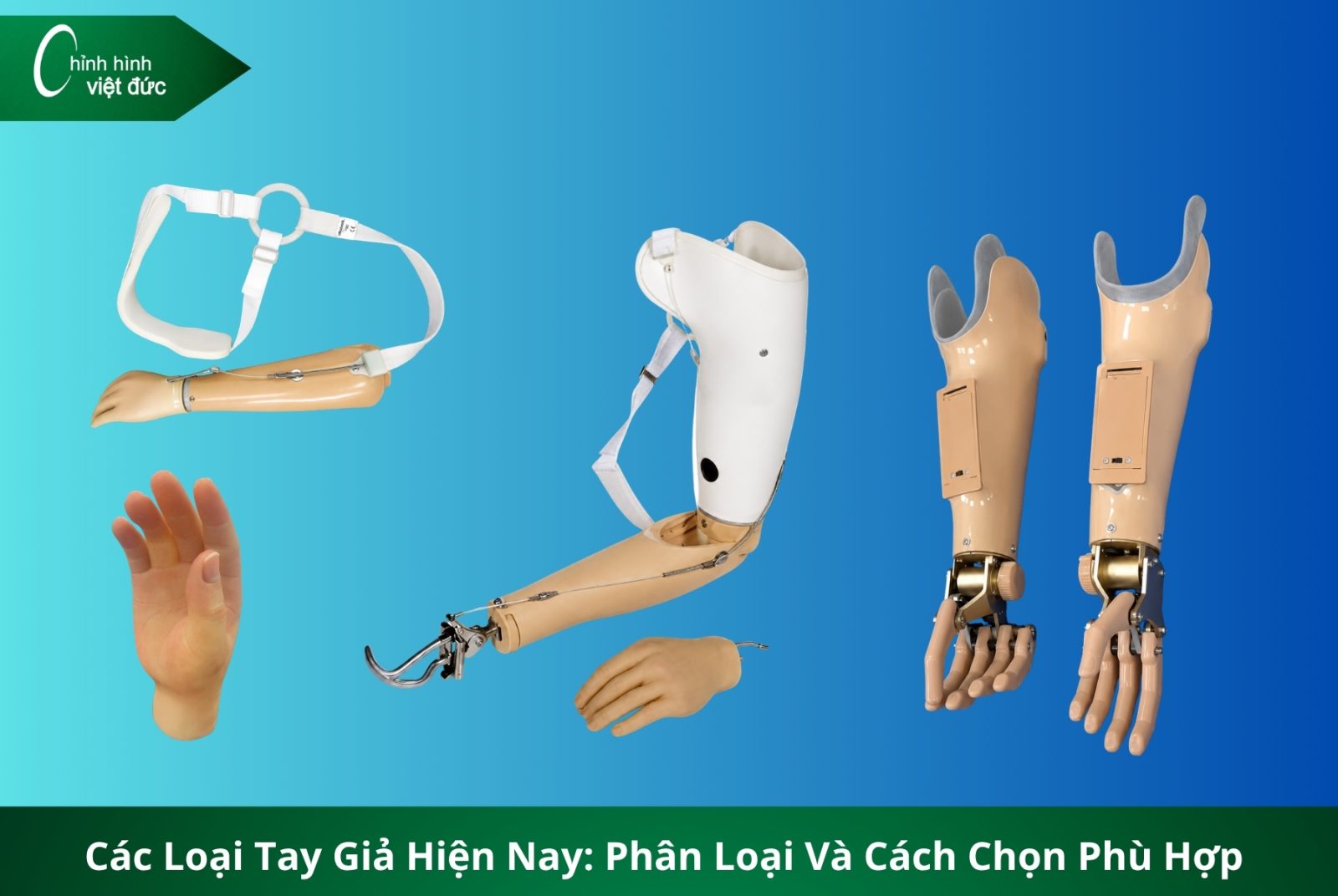 Các Loại Tay Giả Hiện Nay  Phân Loại Và Cách Chọn Phù Hợp