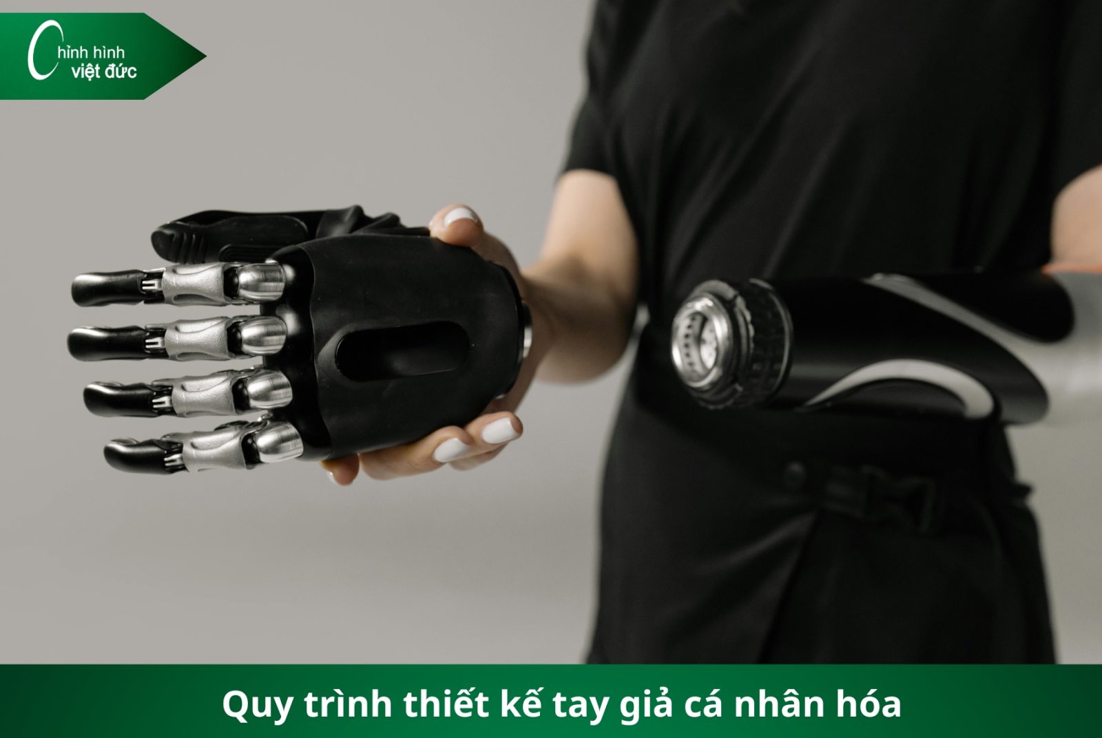 Các Loại Tay Giả Hiện Nay Phân Loại Và Cách Chọn Phù Hợp