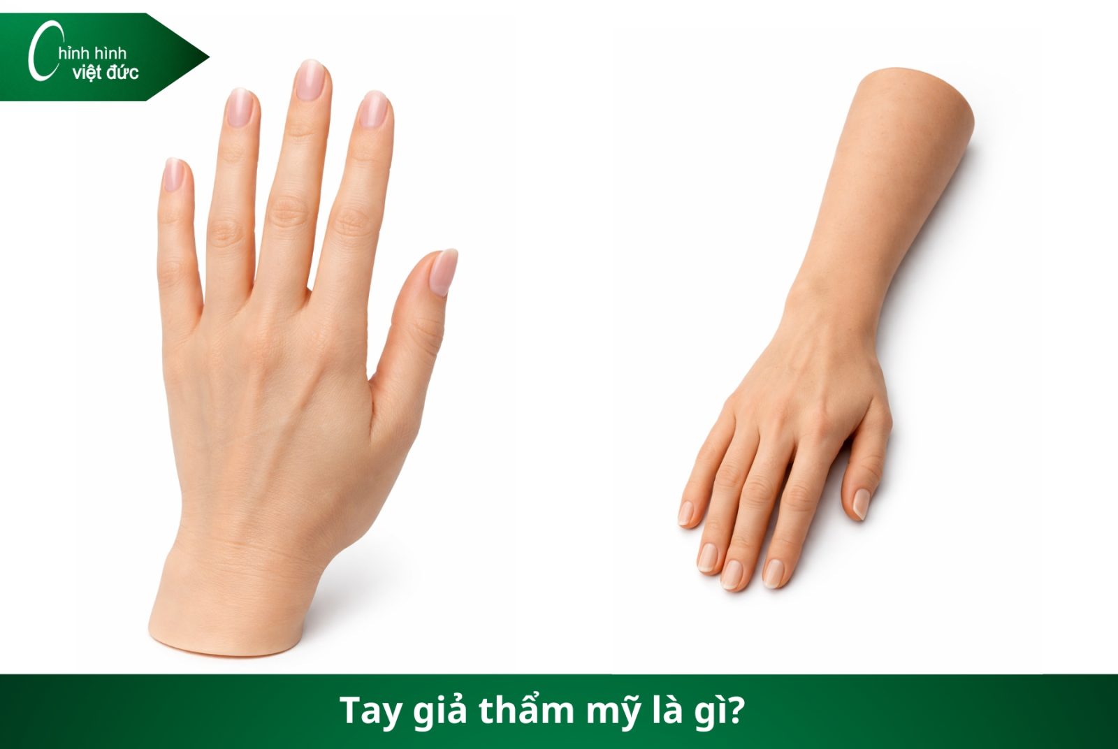 Các Loại Tay Giả Hiện Nay  Phân Loại Và Cách Chọn Phù Hợp