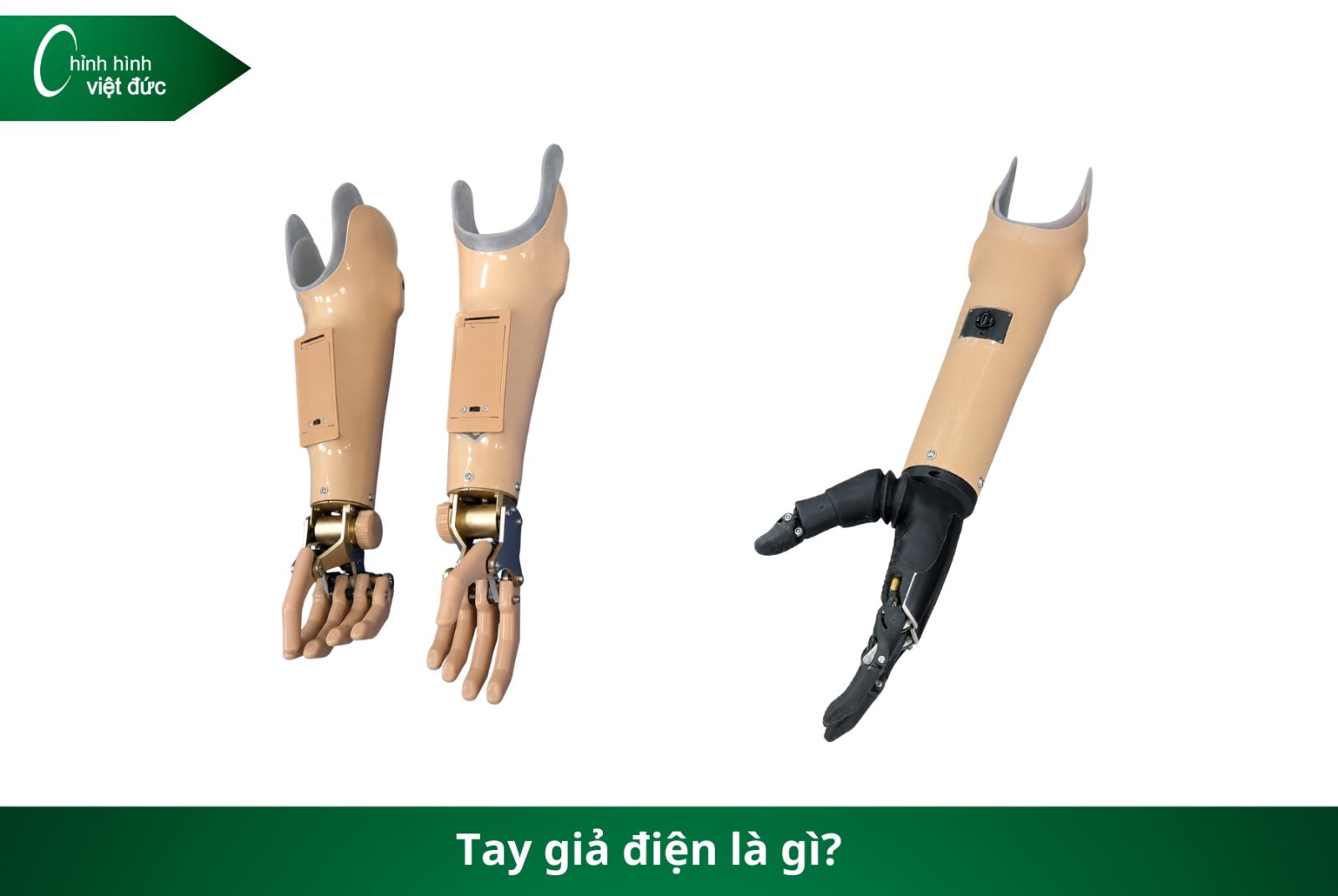Các Loại Tay Giả Hiện Nay  Phân Loại Và Cách Chọn Phù Hợp
