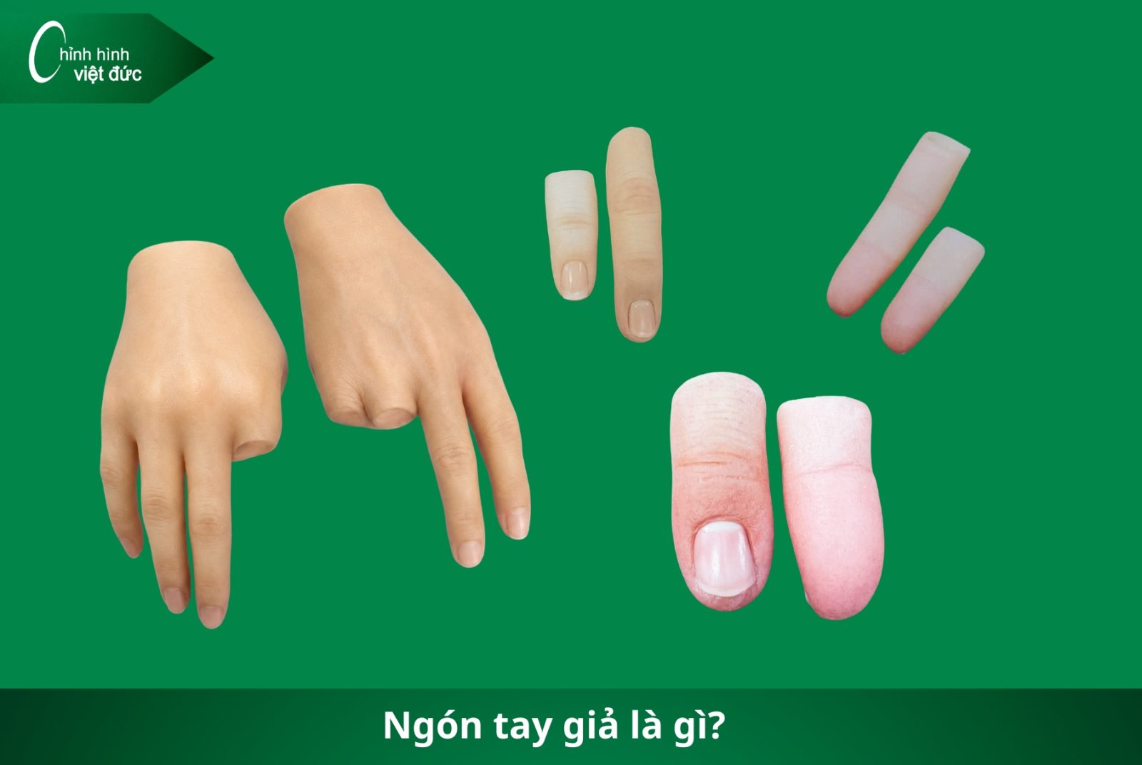 Các Loại Tay Giả Hiện Nay  Phân Loại Và Cách Chọn Phù Hợp