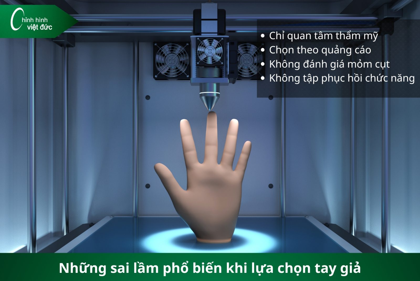 Các Loại Tay Giả Hiện Nay  Phân Loại Và Cách Chọn Phù Hợp