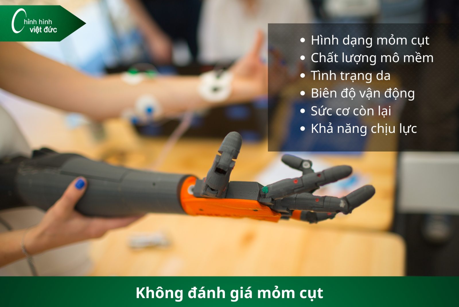 Các Loại Tay Giả Hiện Nay  Phân Loại Và Cách Chọn Phù Hợp