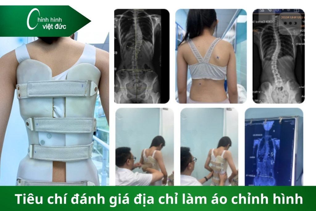 Địa chỉ làm áo chỉnh cong vẹo Hà Nội