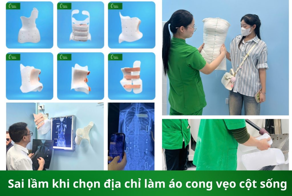 Địa chỉ làm áo chỉnh cong vẹo Hà Nội