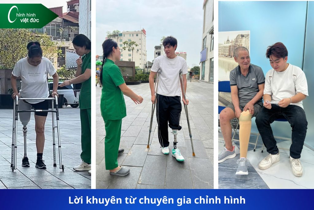 so sánh chân giả carbon và chân giả thường