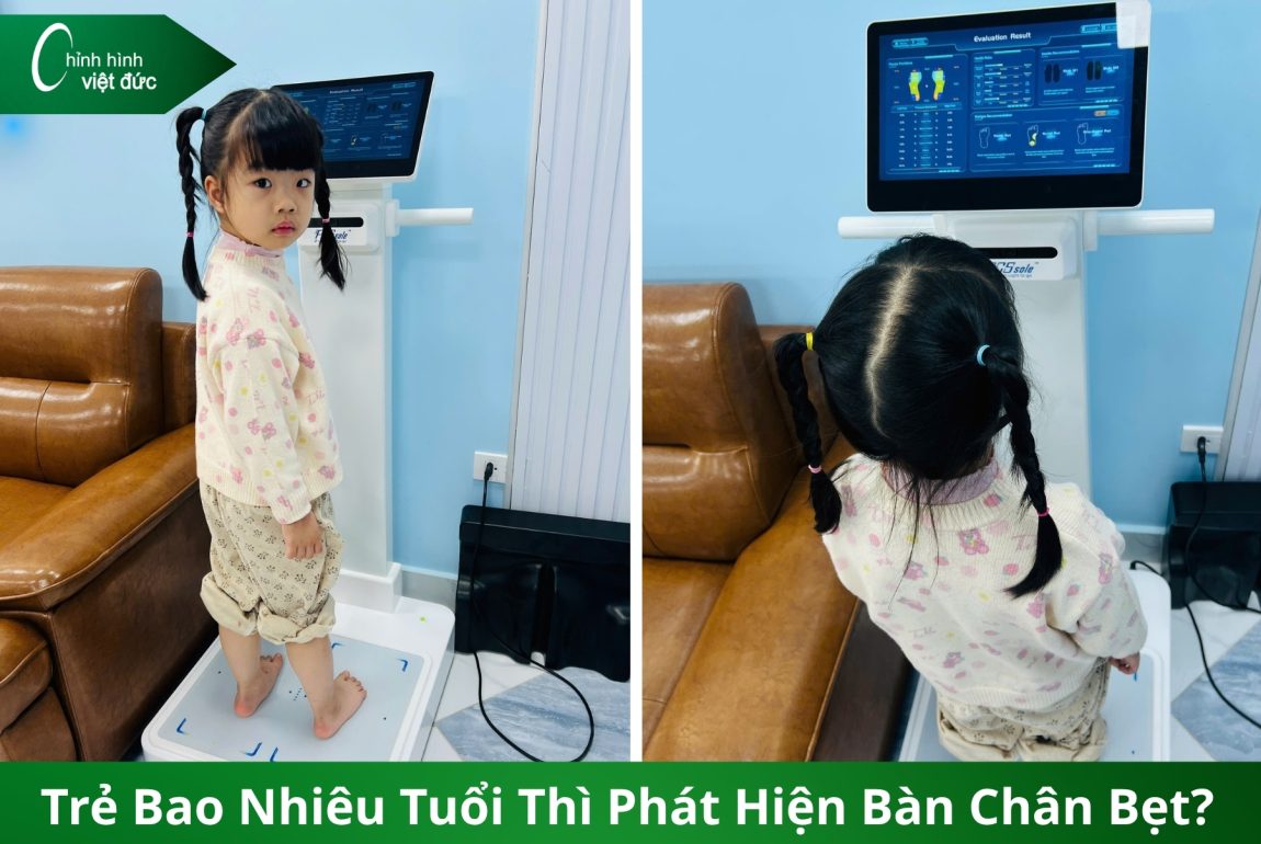 phát hiện bàn chân bẹt