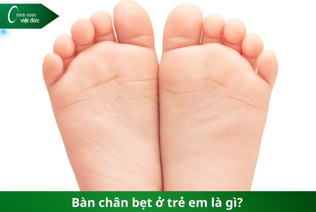 phát hiện bàn chân bẹt