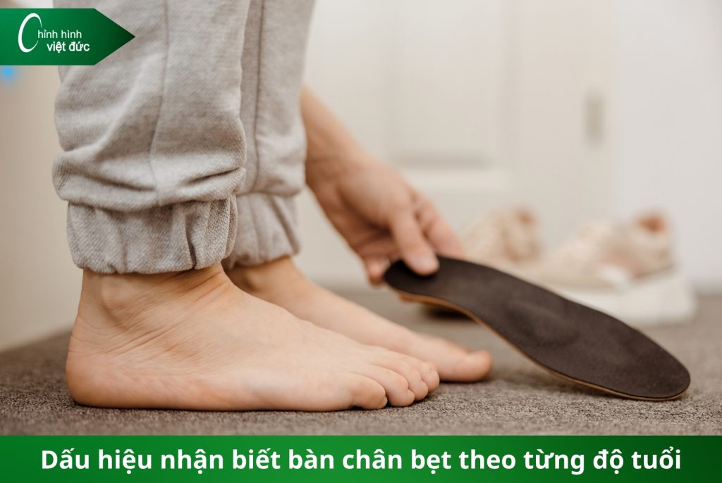 phát hiện bàn chân bẹt