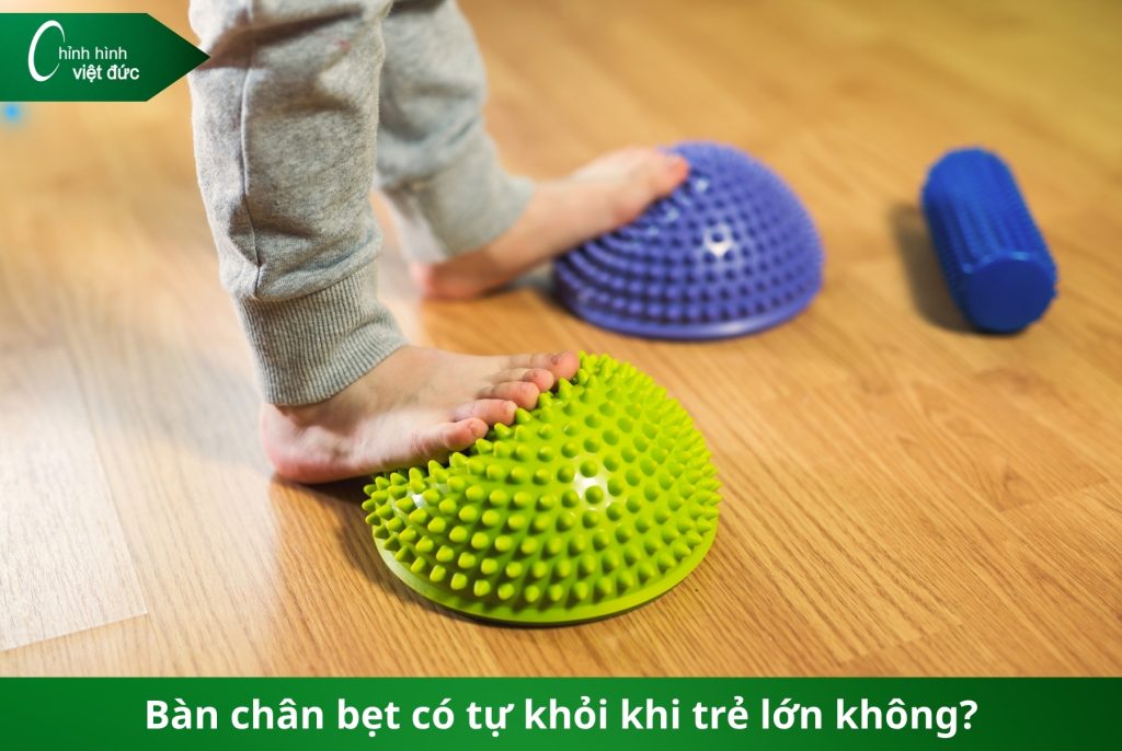 phát hiện bàn chân bẹt