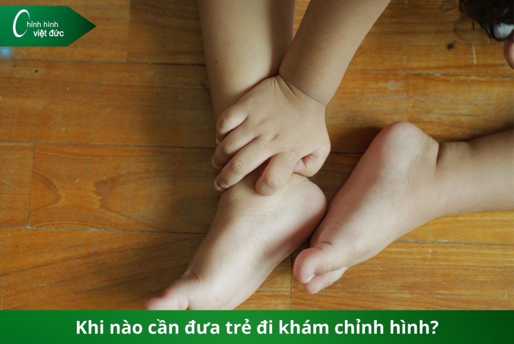 phát hiện bàn chân bẹt