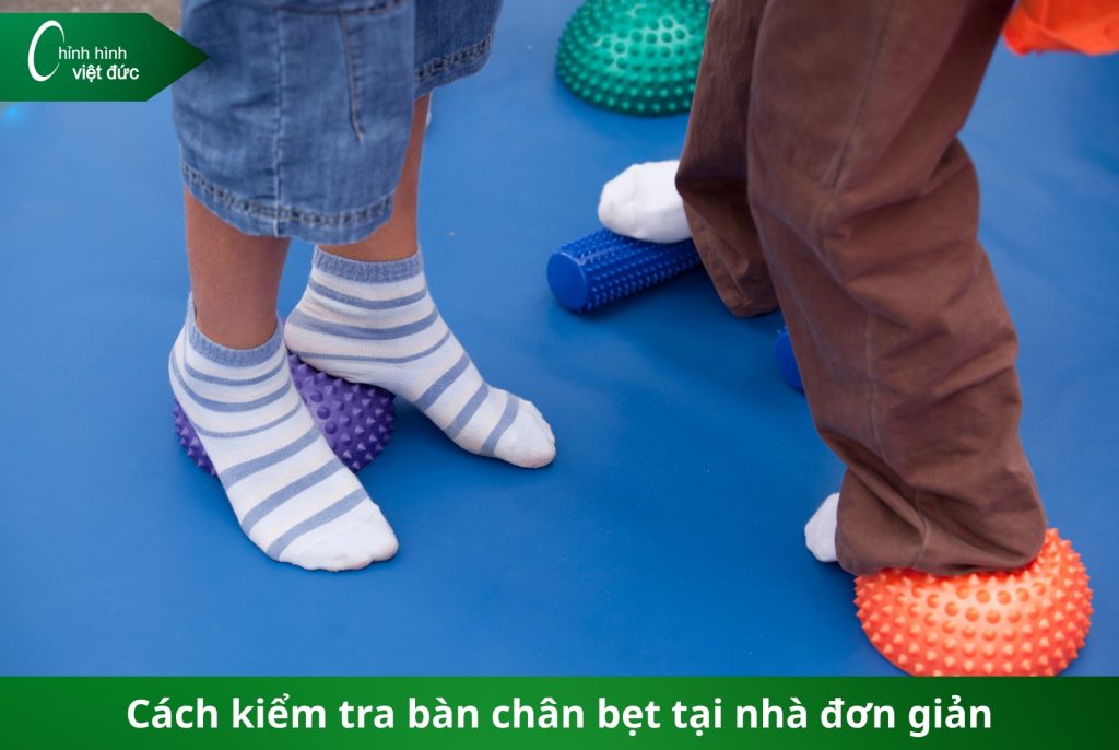 phát hiện bàn chân bẹt