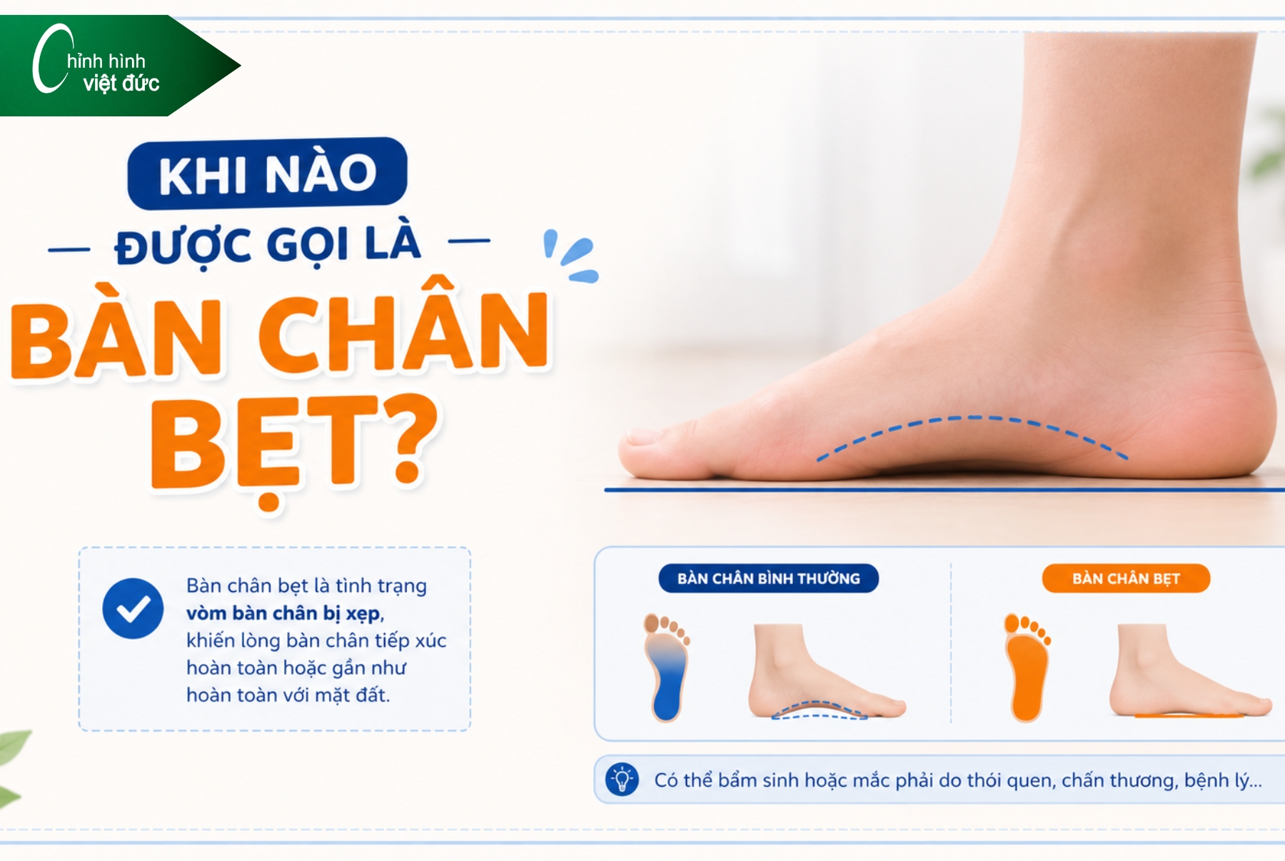 Bàn chân bẹt có tự hết khi lớn không