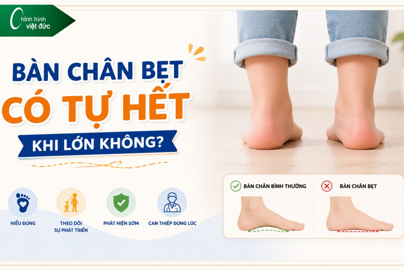Bàn chân bẹt có tự hết khi lớn không