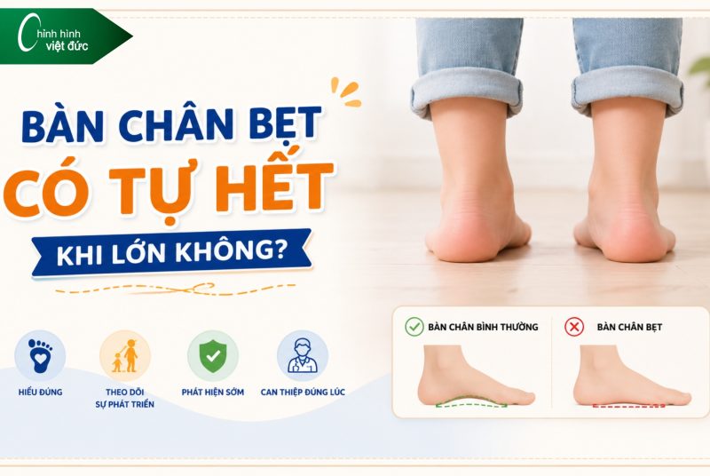 Bàn chân bẹt có tự hết khi lớn không