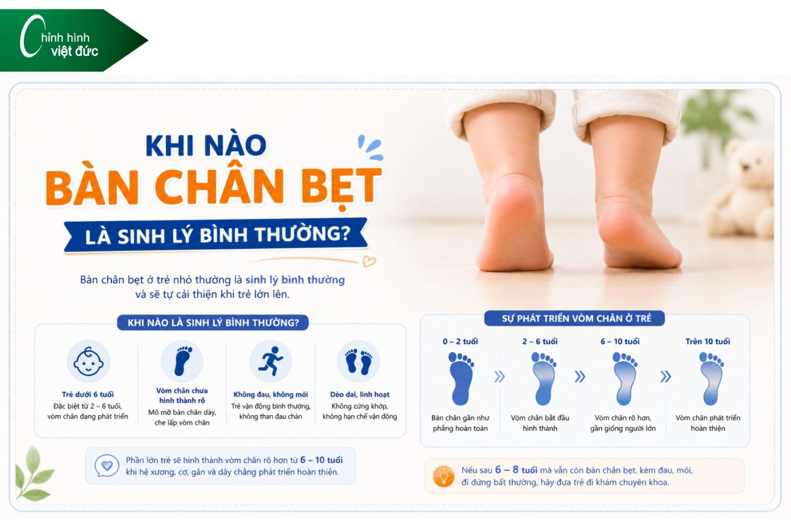 Bàn chân bẹt có tự hết khi lớn không
