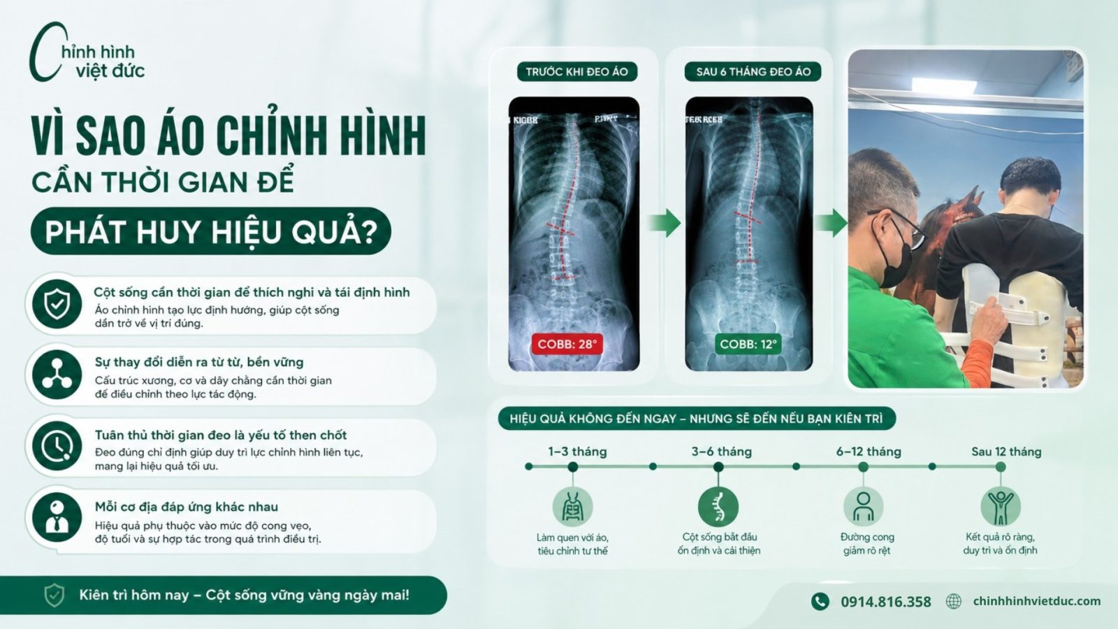 trẻ cong vẹo cột sống cải thiện thế nào