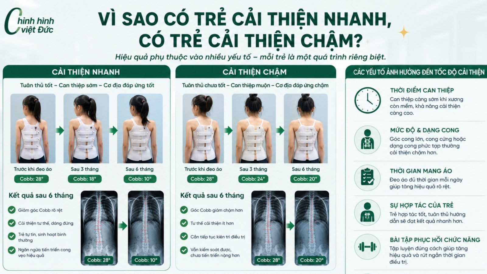 trẻ cong vẹo cột sống cải thiện thế nào