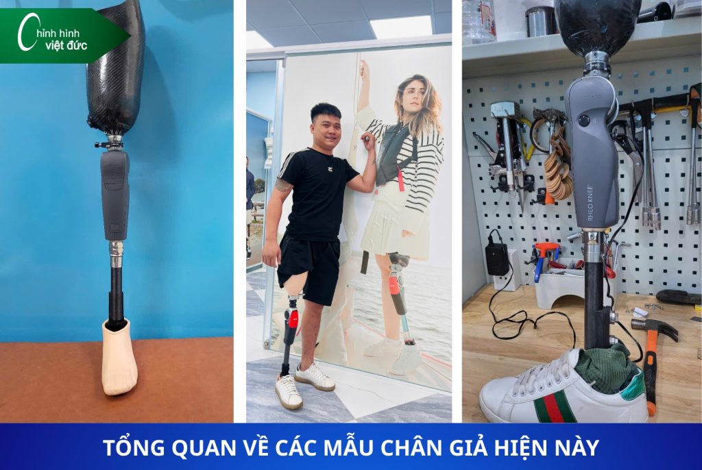 so sánh bàn chân carbon và bàn chân thường