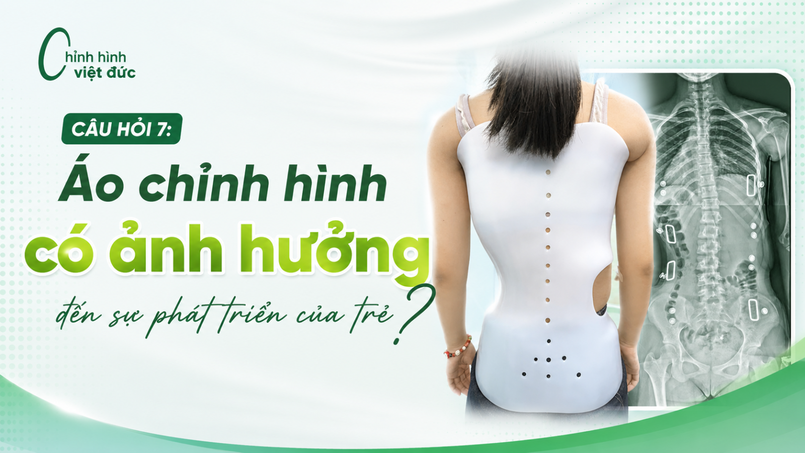 Áo chỉnh hình 10 câu hỏi được phụ huynh quan tâm nhất