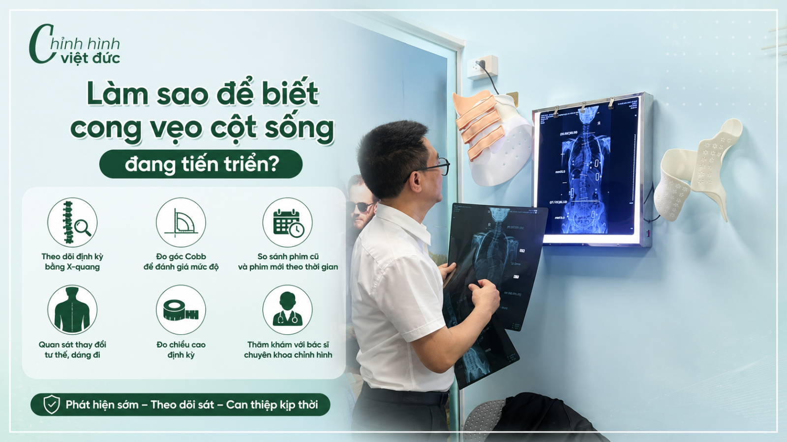 cong vẹo cột sống có thể tiến triển ra sao?