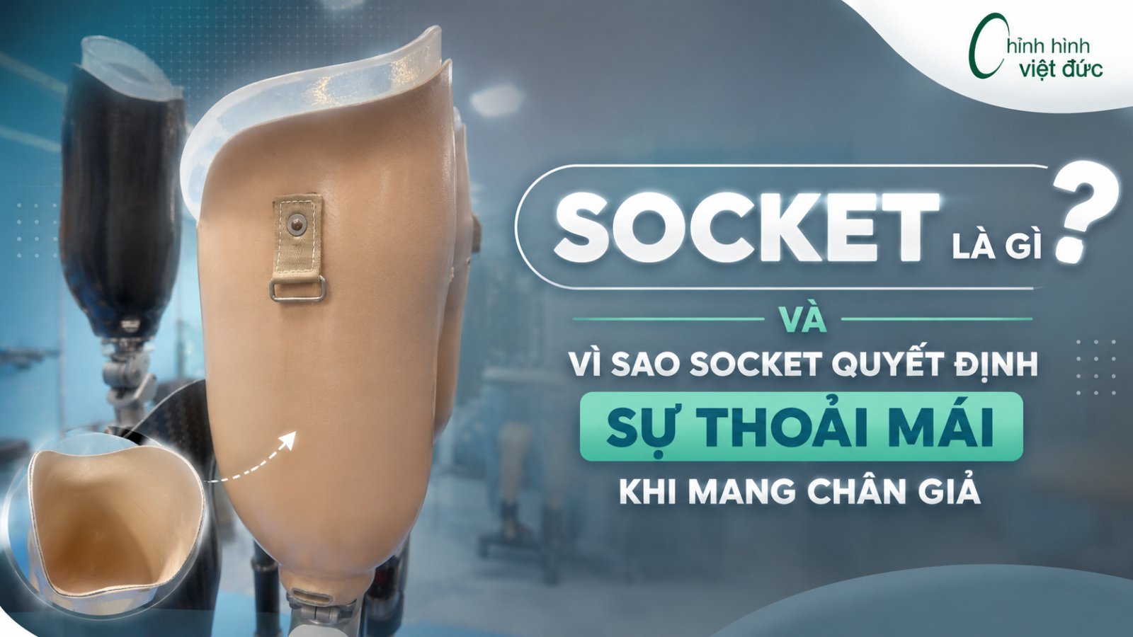 Mỏm cụt để điều kiện làm socket sẽ như thế nào