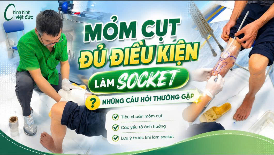 mỏm cụt những câu hỏi thường gặp 