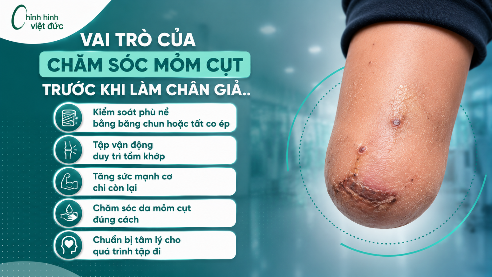 Mỏm cụt - vài trò của quá trình chăm sóc