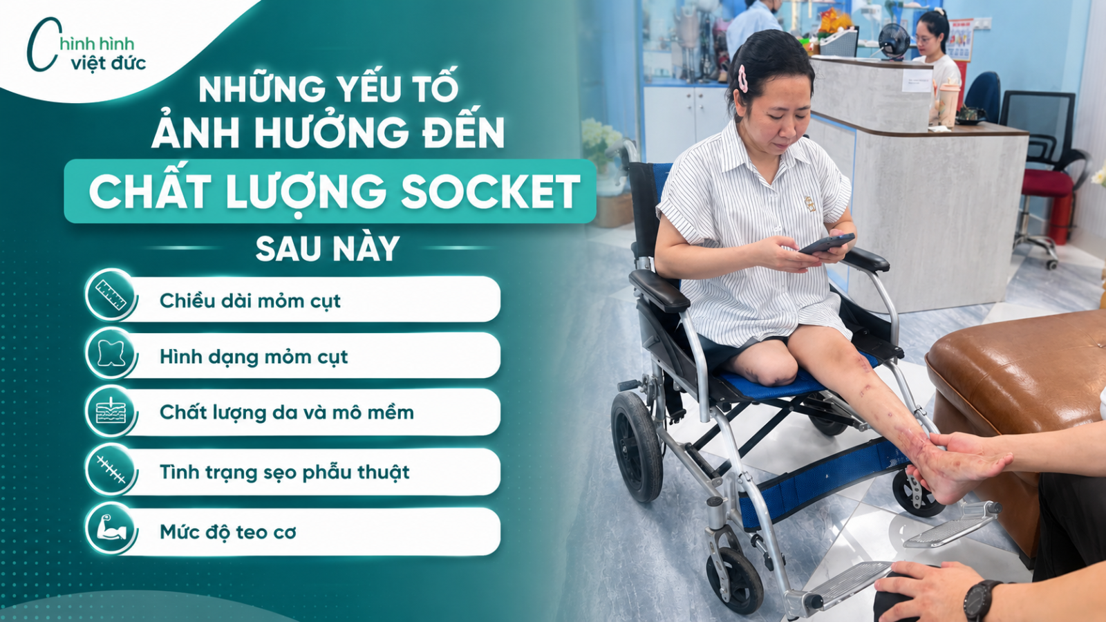 Mỏm cụt - những yếu tố ảnh hưởng đến chất lượng socket 