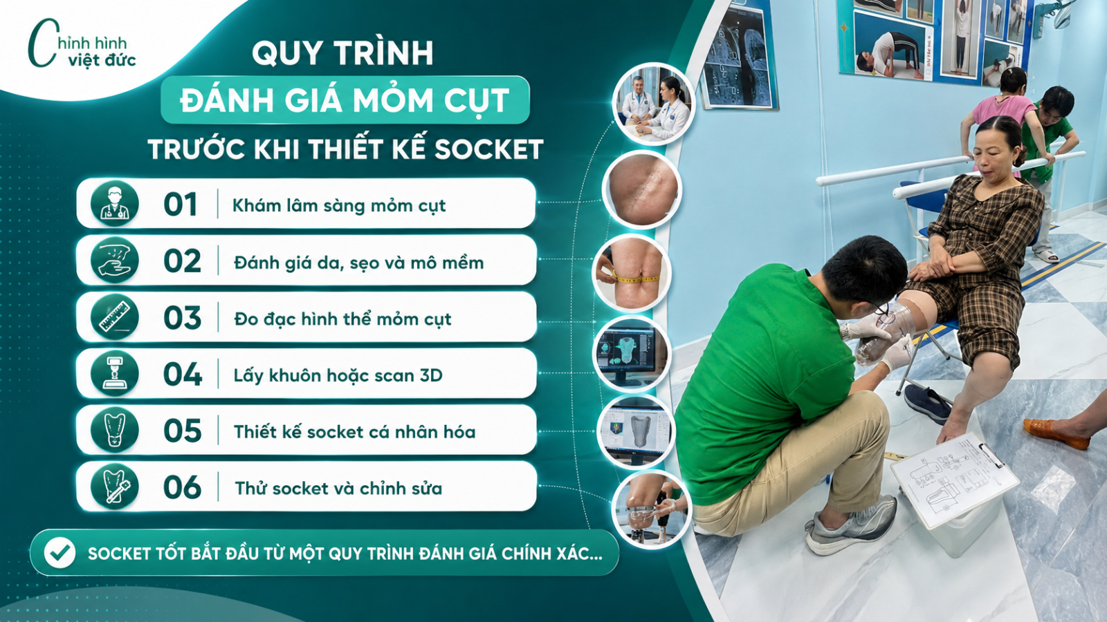 Mỏm cụt quy trình chăm sóc 