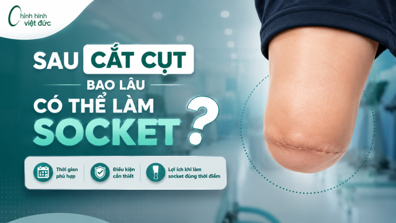 Mỏm cụt để điều kiện làm socket sẽ như thế nào